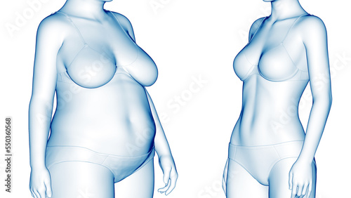 3d rendered medical illustration of an overweight woman's weight loss photo