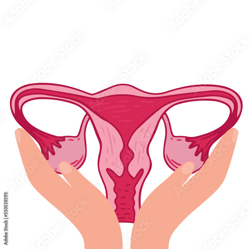Women health - Floral Infographic of Polycystic ovary syndrome. Patient-friendly scheme of PCOS, Multifollicular cyst. Gynecological problems - Neutral medical diagram uterus and uterine appendages