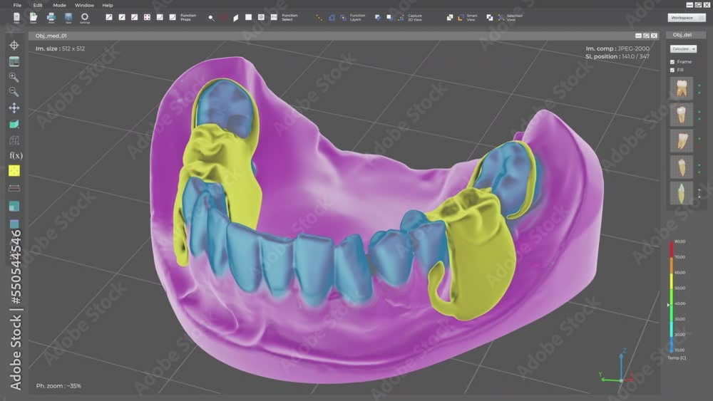 Innovative Dentistry Program Displays Restorations Replacing Damaged