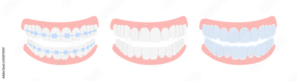Obraz premium Braces, mouthguards, and aligners for correction jaw and teeth, isolated on white background. Concept dental medecine, stomatology. Cartoon flat design. Vector illustration.