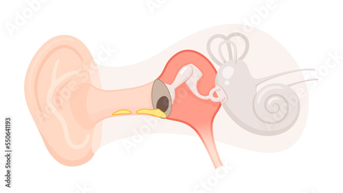 耳の構造のイラスト_慢性中耳炎_鼓膜穿孔と耳漏