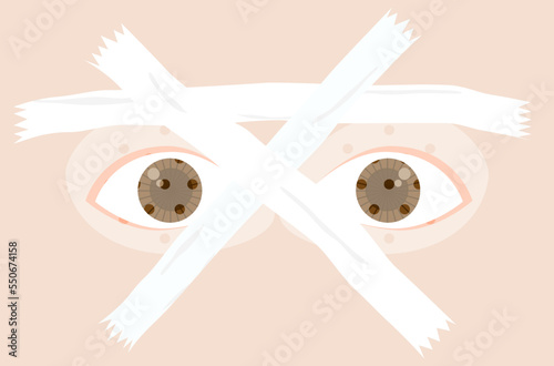 Flat design of eyes recovery from lasik surgery vector, Femto cure shortsighted eyes vector, eyes are covered by eye shield after lasik surgery vector, flat design of eyes protection vector.