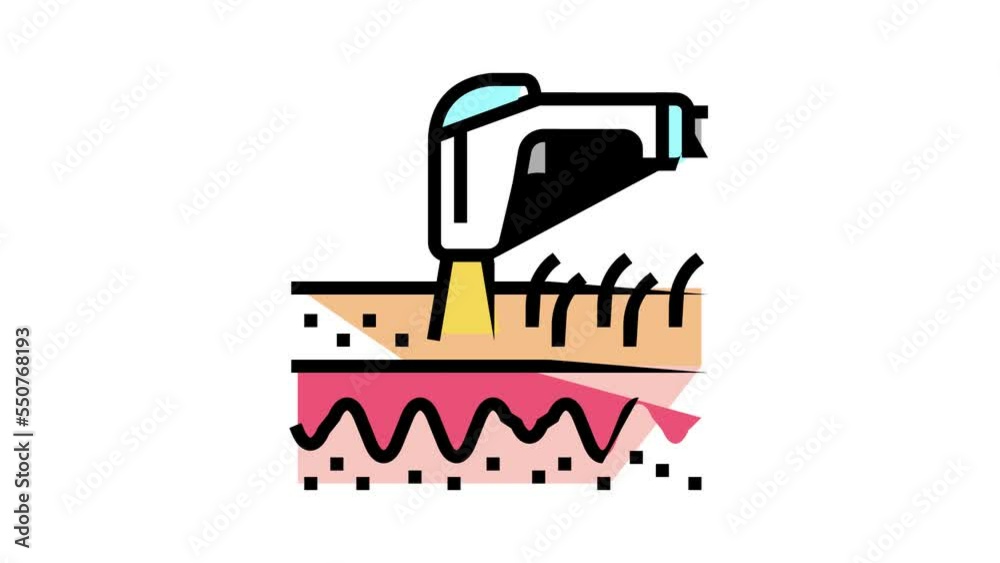 laser depilation device color icon animation
