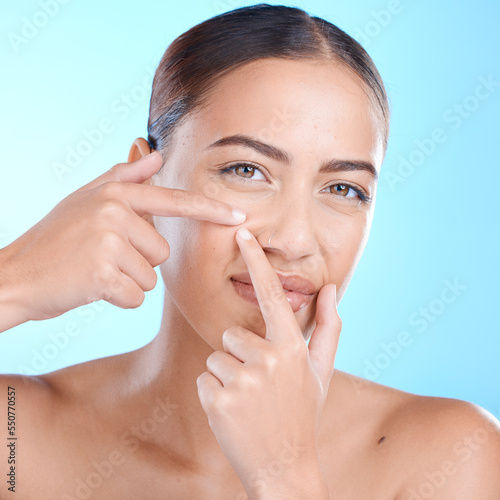 Skincare  portrait and woman squeeze a pimple in a studio for a natural facial treatment. Beauty  cosmetic and girl model from brazil with a face acne routine for health isolated by a blue background