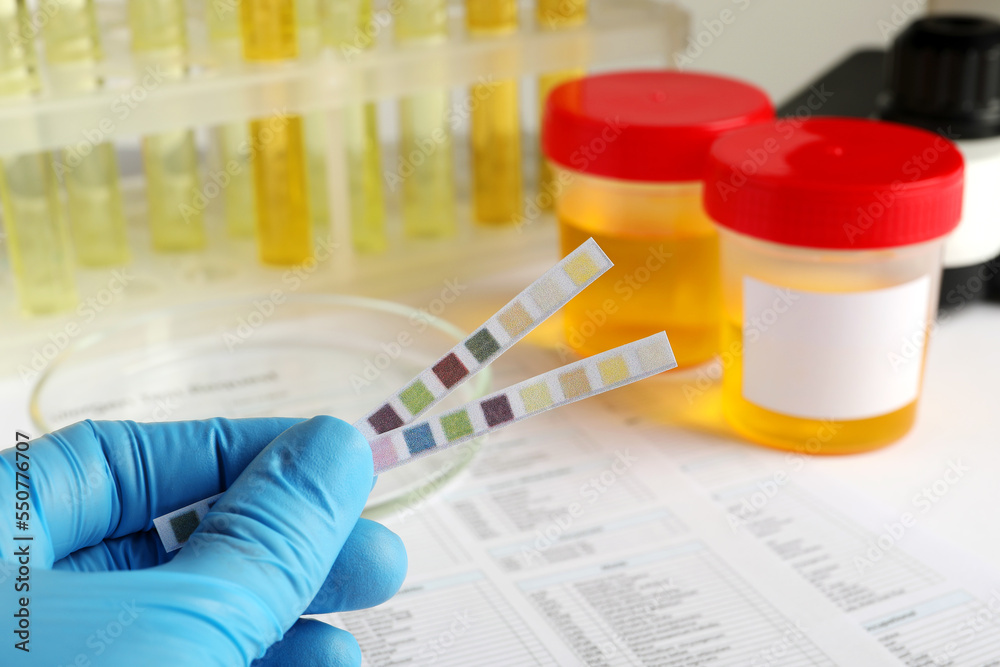 Nurse holding test strips at table, closeup. Urine analysis Nurse holding test strips at table, closeup. Urine analysis