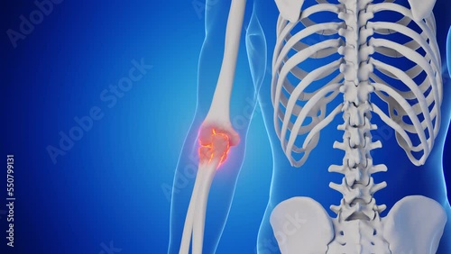 3d rendered medical animation of a man's right elbow joint photo