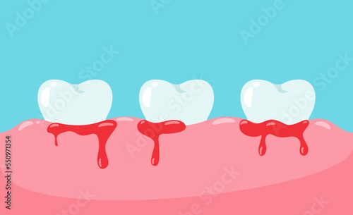 Teeth bleeding on the gums vector 
