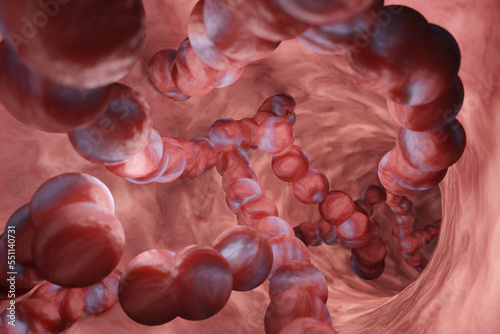 Photos Strep A bacterial structure in a throat