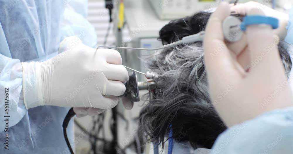 The assistant holds in his hands endoscopic biopsy forceps such as