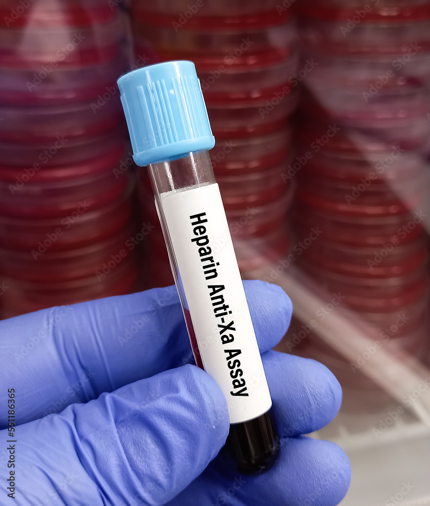 Blood sample for Heparin ANTIXA assay test to diagnosis for clotting