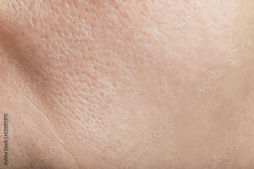 Closeup view of human skin as background