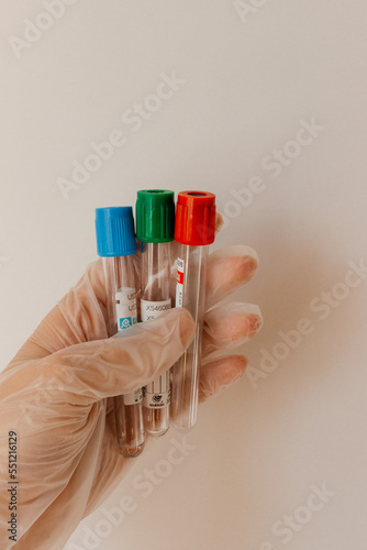 Glass test tube in the hands of a scientist. A scientistin rubber disposable gloves holds a laboratory flask and for analysis.