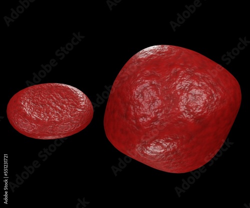 Isolated swollen erythrocyte with normal red blood cell. Macrocytic anemia 3d rendering photo