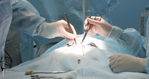 In a veterinary clinic, a surgeon and his assistant perform an operation on the abdominal cavity of a pet. The pet is covered with a blue operating field. Two gloved hands hold a surgical instrument.