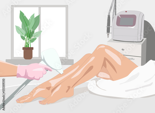 Illustration.Elos epilation, hair removal procedure on a woman’s body. Beautician doing laser rejuvenation in a beauty salon. Removing unwanted body hair. 