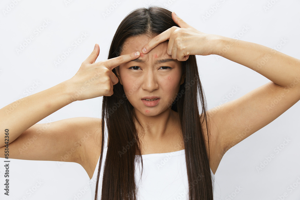 Asian woman facial skin problems, acne and inflammation, red rashes and allergies, chicken pox, sadness from rashes. Facial skin care concept for diseases and nerves Asian woman facial skin problems, acne and inflammation, red rashes and allergies, chicken pox, sadness from rashes. Facial skin care concept for diseases and nerves