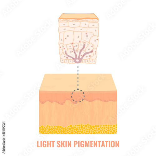 Melanin content and distribution in light skin. Fair complexion pigmentation mechanism infographic diagram. Epidermis cross-section in closeup. Vector illustration.