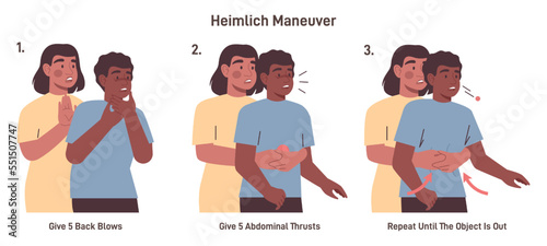 Choking first aid for adult. Heimlich maneuver procedure to remove photo