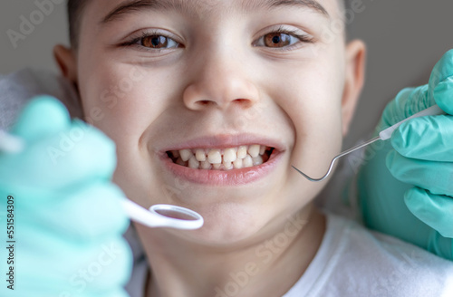 pediatric dentist dental check up happy smiling kid preschooler boy and hand in surgical green gloves with instruments holding mouth mirror explorer probe curve stickle jacquett scaler.diastema gaps 