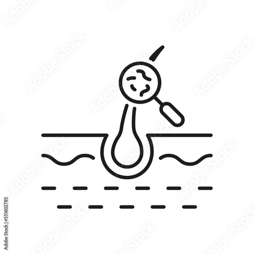 Hair Treatment Line Icon. Lice Magnifying on Skin Linear Pictogram. Medical Problem in Hair Follicle Outline Icon. Health Care, Hygiene Head Skincare. Editable Stroke. Isolated Vector Illustration