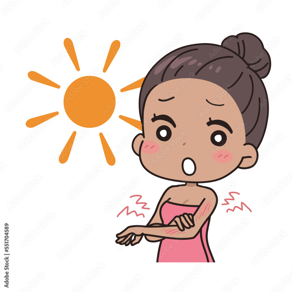 Illustration of a woman before and after sunburn. Illustration of a woman before and after sunburn.