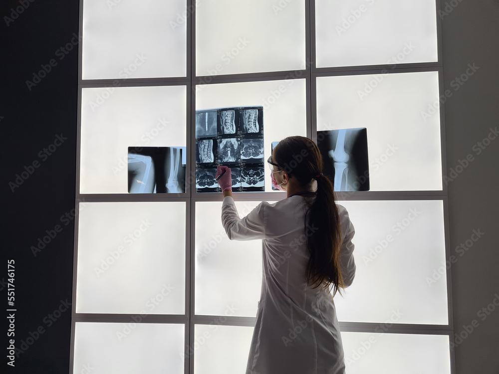 Radiologist checks x-ray image on light box Radiologist checks x-ray image on light box