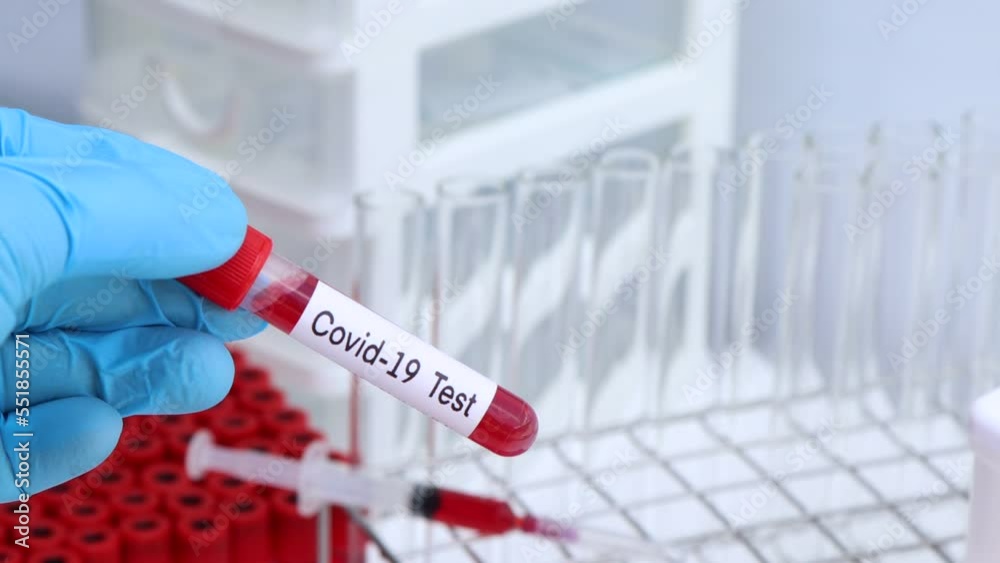 Covid-19 test to look for abnormalities from blood, blood sample to analyze Covid-19 test to look for abnormalities from blood, blood sample to analyze