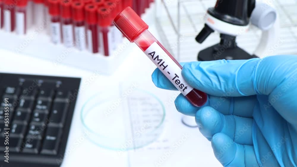 AMH test to look for abnormalities from blood, blood sample to analyze in the laboratory, blood in test tube AMH test to look for abnormalities from blood, blood sample to analyze in the laboratory, blood in test tube
