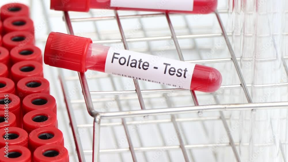 Folate test to look for abnormalities from blood, blood sample to