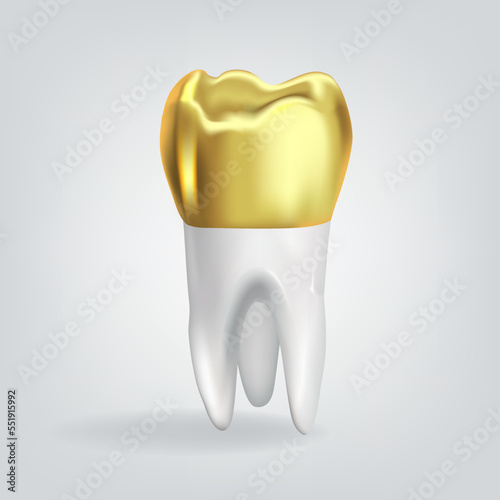 Realistic tooth with golden crown. Vector illustration