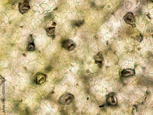 Suculent Echeveria leaf under the microscope showing stomata - optical microscope x200 magnification photo