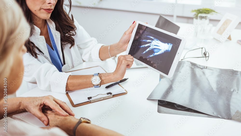 Young doctor examining x-ray of hands of a senior patient with arthritis. Radiography of a hand. Doctor holding film medical x-ray both hand for checking injury. Skeleton bone disease exam medic aid