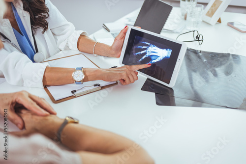 Doctor and patient looking at x-ray and hand in doctor's office. Close-up of female hands holding skiagram. Serious surgeon looking attentively on wrist x-ray and making diagnosis.  photo
