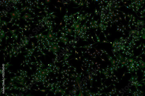 Microfilaments, nuclei, and mitochondria of fibroblasts
