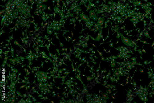 Microfilaments, nuclei, and mitochondria of fibroblasts