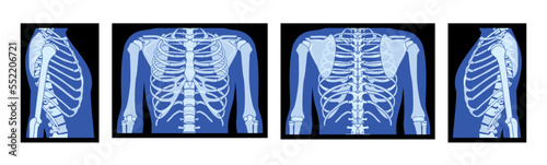 Set of X-Ray rib cage and hands Skeleton Human body Bones adult people roentgen front back side view. 3D realistic flat blue color Vector illustration of medical anatomy isolated on black background