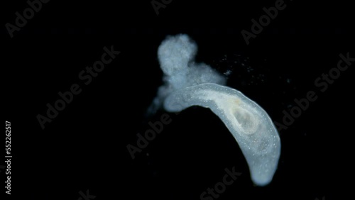 Flatworm Macrostomum sp. under a microscope, of the family Macrostomidae, Platyhelminthes Phylum. Video shows how defecation occurs through the mouth photo