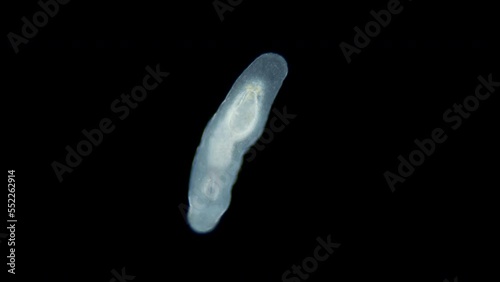 Flatworm Macrostomum sp. under a microscope, of the family Macrostomidae, Platyhelminthes Phylum. photo