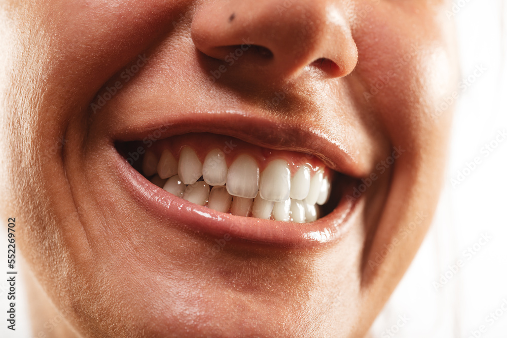 Fototapeta premium Good looking teeth
