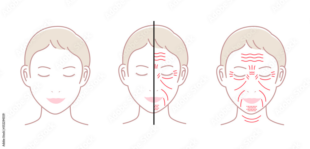 Facial wrinkles ( female face ) vector illustration set / no text Facial wrinkles ( female face ) vector illustration set / no text