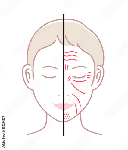 Facial wrinkles ( female face ) vector illustration / no text