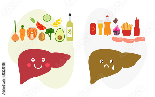 Healthy and diseased liver. Liver Awareness Month. Info-graphic. Vector illustration  isolated on white background