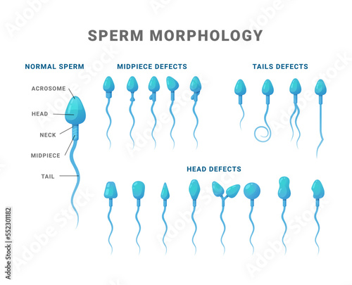 Sperm morphology count type educational medical scheme vector flat illustration