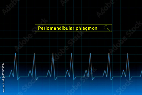 Periomandibular phlegmon.Periomandibular phlegmon inscription in search bar. Illustration with titled Periomandibular phlegmon . Heartbeat line as a symbol of human disease. photo