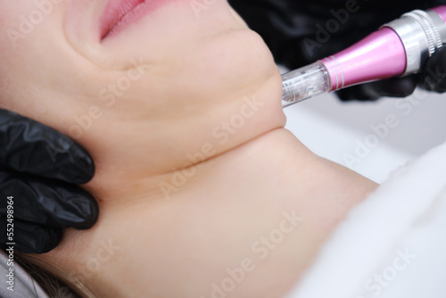 Double chin removal with mesotherapy. Close up photo