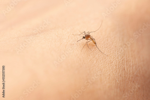 Mosquito bite uncovered human skin