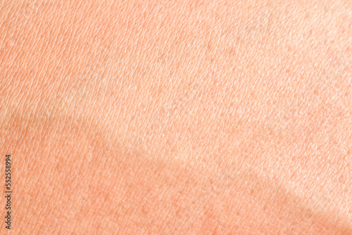 Abstract close-up human skin background texture.