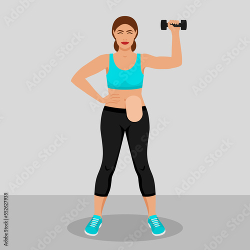 Young woman with colostomy bag is engaged in fitness with dumbbell. Vector illustration photo