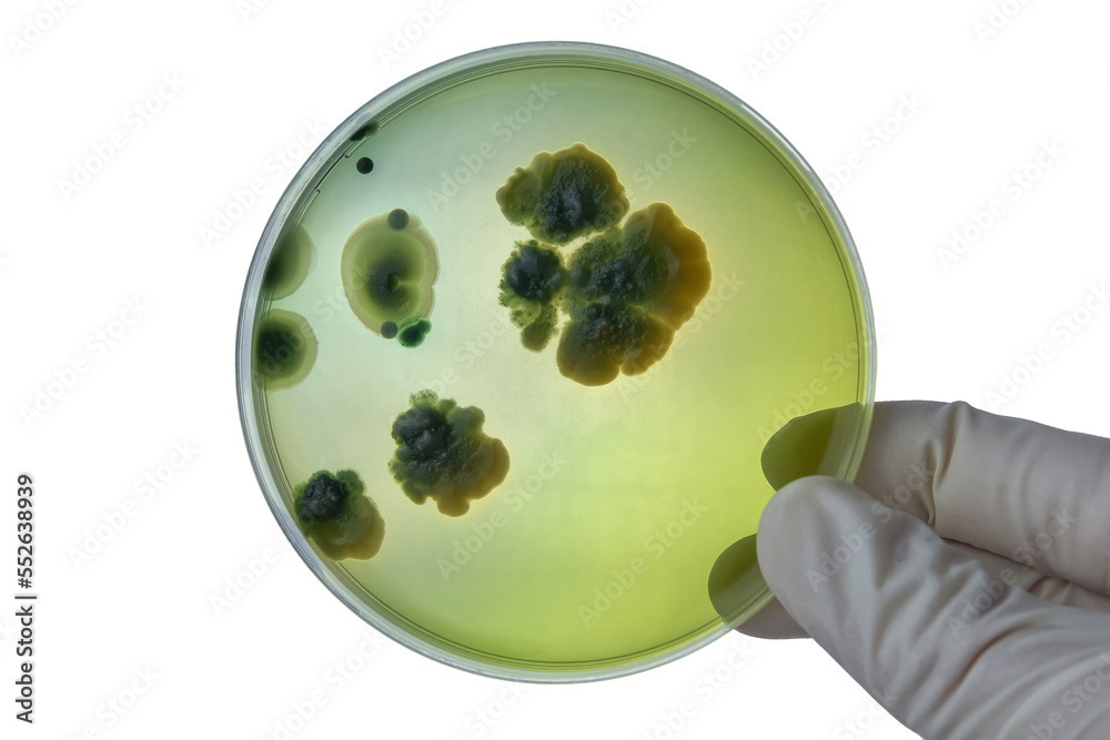 Hand with Petri dish or culture media with bacteria on white background ...