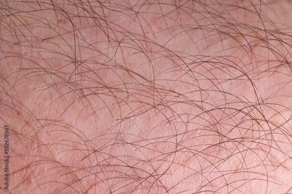 Fototapeta premium Skóra człowieka porośnięta czarnymi włosami. 